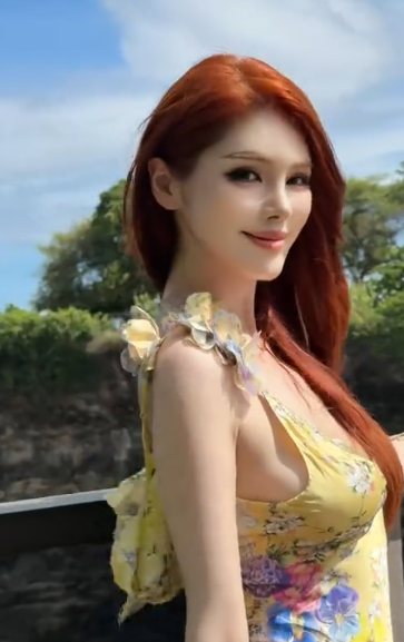 图片[3]-斗鱼三S的张琪格换平台后，人气下滑，称自己最近压力大到淋巴长痘口腔溃疡！网友:应该是年纪上去了，代谢慢！-吃瓜网